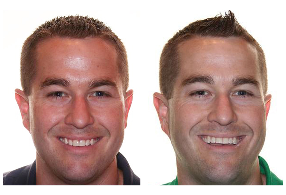 Thomas Fitzsimmons, DDS