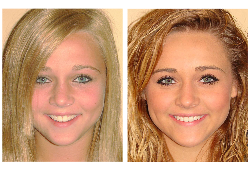 Thomas Fitzsimmons, DDS