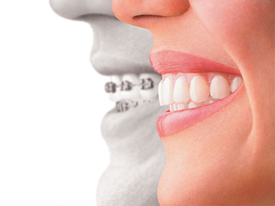 Thomas Fitzsimmons, DDS | Dentures, Preventative Program and Periodontal Treatment