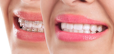 Thomas Fitzsimmons, DDS | Extractions, Teeth Whitening and Dental Fillings