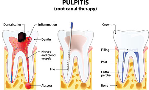 Thomas Fitzsimmons, DDS | Oral Exams, Digital Radiography and Dental Bridges