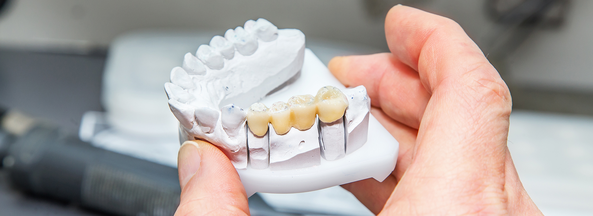 Thomas Fitzsimmons, DDS | Root Canals, Dental Bridges and Extractions