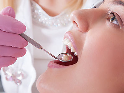 How a Dentist Treats a Loose Dental Filling - Smiles By Julia Fort
